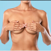 Breast Augmentation 03 2