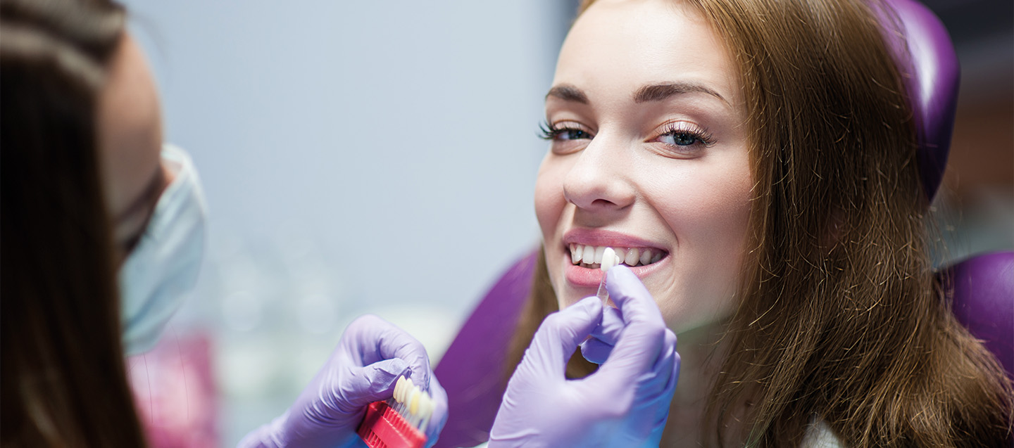 Qué es una corona dental, cuándo es necesaria y qué tipos hay? • Clínica  Dental AVODENT