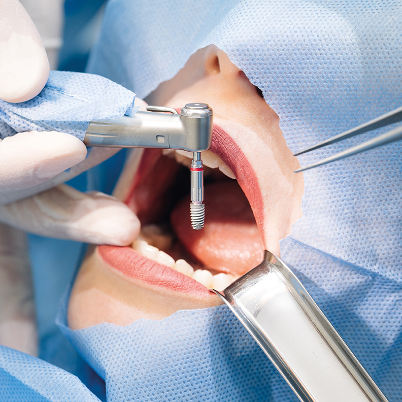 Is dental implant surgery a painful procedure
