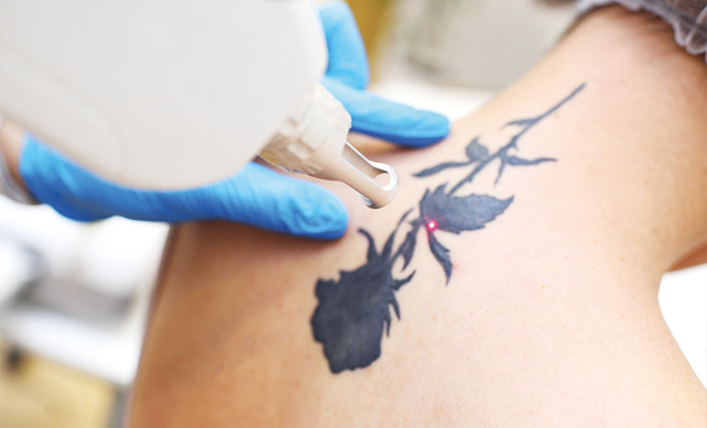 PicoSure™ Laser Tattoo Removal - 207 Laser & Integrative MED only provider  in ME