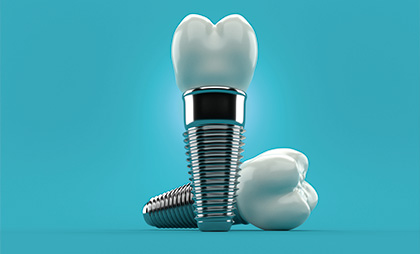 Tooth Implant 05