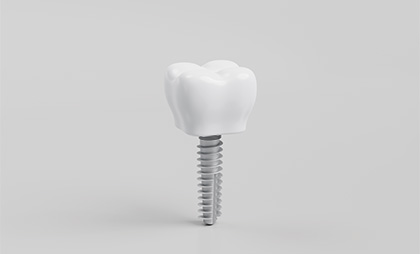Tooth Implant 07