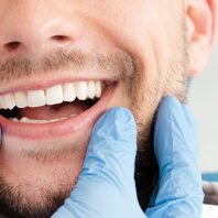Dental Aesthetics 2