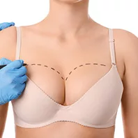 Breast Augmentation-27