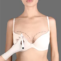 Breast Augmentation-58