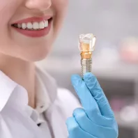 Dental implant 35
