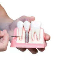 Dental implant 46