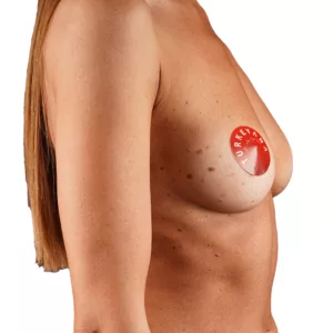 breast7 before beyaz